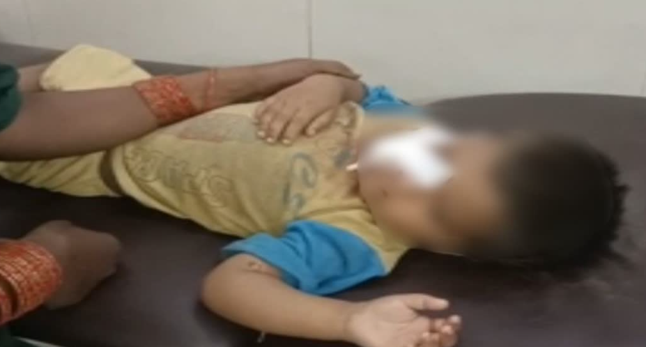 बहराइच में भेड़ियों, तेंदुओं के बाद आवारा कुत्तों का आतंक, 3 साल के बच्चे पर हमला, हालत गंभीर